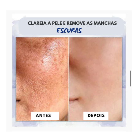 𝐅𝐮𝐛𝐬𝐭𝐚® Creme Firmador e Redutor de Rugas Avançado: Restaura a Elasticidade da Pele